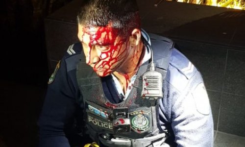 Sydney: Cảnh sát bị chém vào đầu khi trấn áp nghi phạm