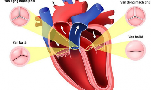 BỆNH VAN TIM: - Triệu chứng, Nguyên nhân, Chẩn đoán, & Điều trị