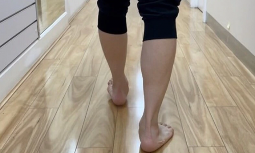 Hội chứng bàn chân bẹt và đau gót chân