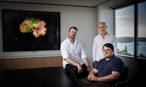 Công ty khởi nghiệp huy động số vốn 30 triệu đô-la tạo bản đồ não bộ để hỗ trợ các cuộc phẫu thuật và trị liệu