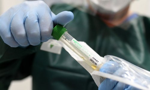 Các nhà khoa học Australia sắp thử nghiệm vaccine coronavirus Covid-19 trên người