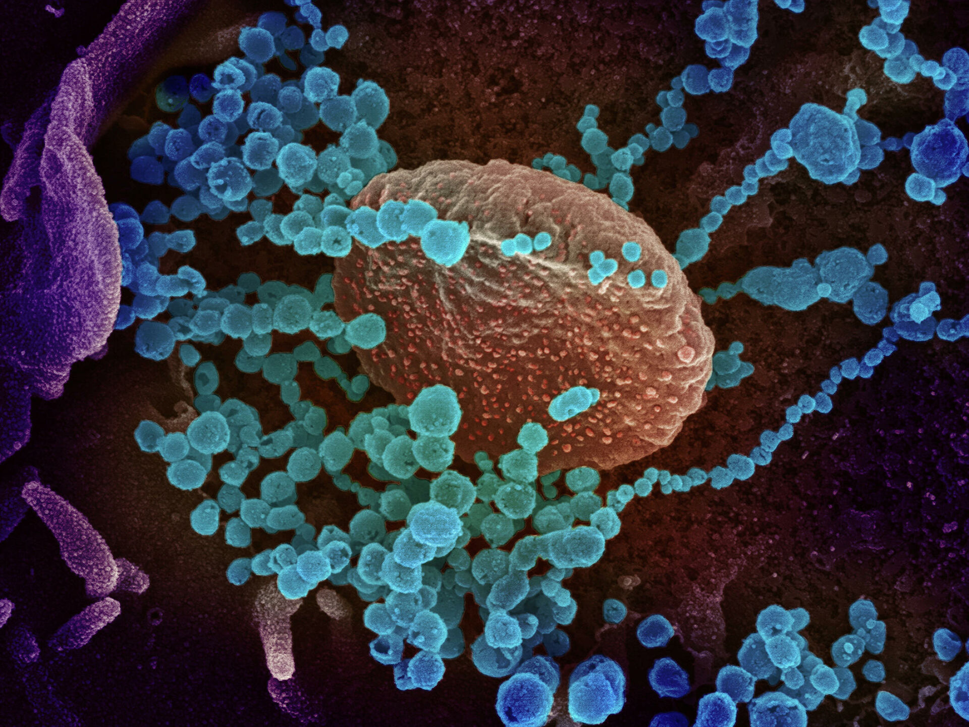 Theo dõi đường lây lan của virus SARS-CoV-2 bằng công nghệ giải trình gene siêu nhanh.