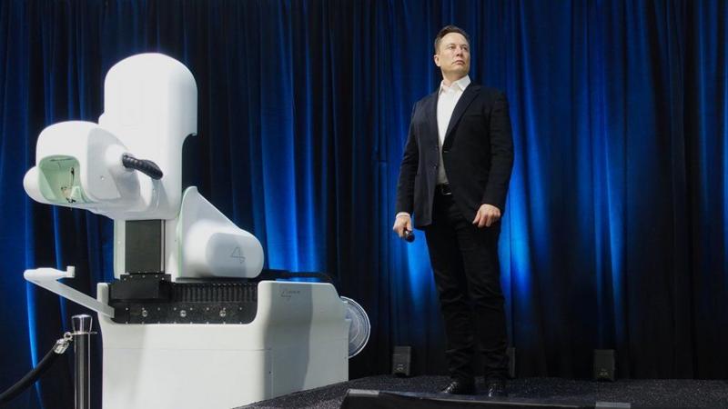 Neuralink: Công nghệ não bộ của Elon Musk sẽ thay đổi thế giới?