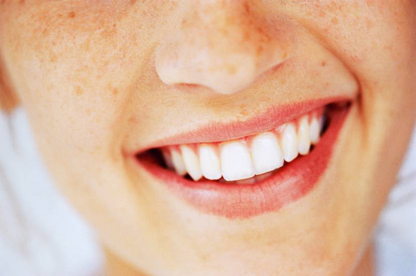 ACCC phạt EZ Smile hàng nghìn đô-la vì 'gây hiểu lầm cho khách hàng' vì chỉnh nha thẩm mỹ.